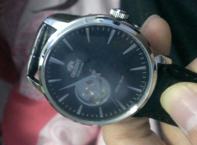 Đồng Hồ Rolex Bị Vô Nước: Nguyên Nhân, Cách Khắc Phục Và Phòng Tránh Hiệu Quả