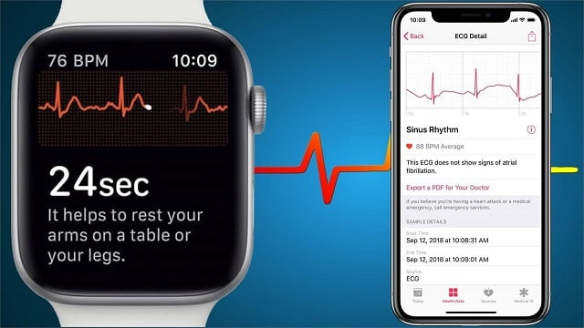 Đồng hồ Apple Watch Series 4 nổi bật với ứng dụng ECG hỗ trợ sức khỏe