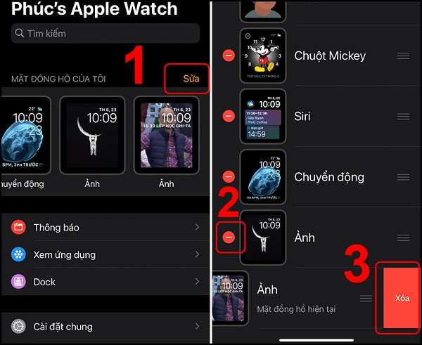 Các bước xóa mặt đồng hồ Apple Watch qua ứng dụng Watch trên điện thoại iPhone.