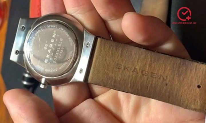 Thay Dây Đồng Hồ Skagen Ở TPHCM: Hướng Dẫn Chi Tiết Từ A Đến Z Thay Dây Đồng Hồ Skagen Ở TPHCM: Hướng Dẫn Chi Tiết Từ A Đến Z