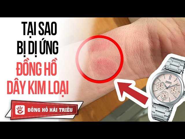 Đeo Đồng Hồ Bị Nổi Hạt: Nguyên Nhân, Cách Xử Lý và Bí Quyết Phòng Ngừa Hiệu Quả